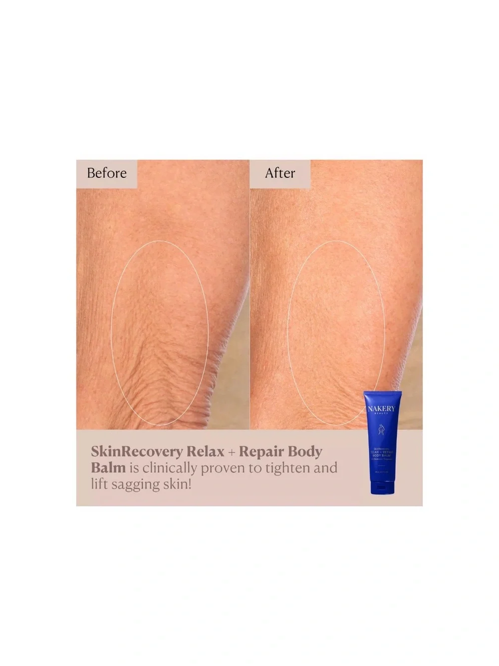 Nakery SkinRecovery Relax + Repair Body Balm - Picture 2 of 4